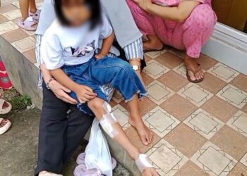 Seorang anak kecil korban gigitan monyet liar yang lepas dari kandang satwa milik BPBD Kabupaten Tangerang, Sabtu (12/04/2025). Foto: AGH.