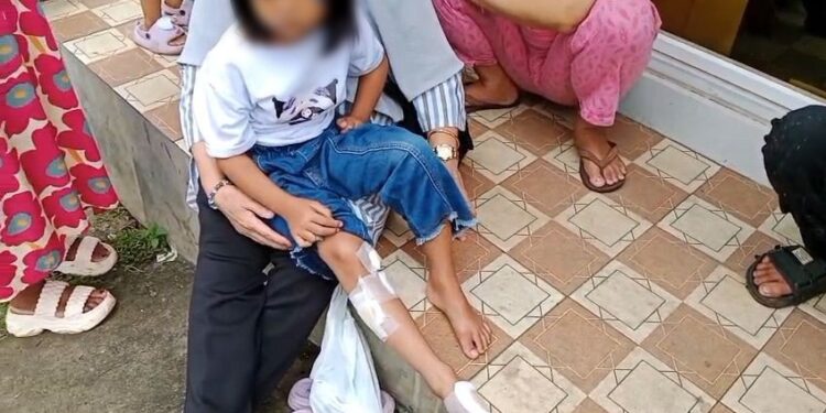 Seorang anak kecil korban gigitan monyet liar yang lepas dari kandang satwa milik BPBD Kabupaten Tangerang, Sabtu (12/04/2025). Foto: AGH.